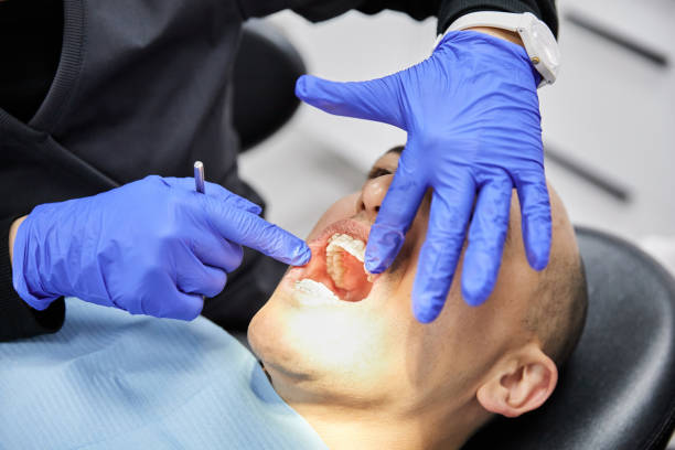 Best Urgent Care for Lost Fillings or Crowns in Purdy, WA